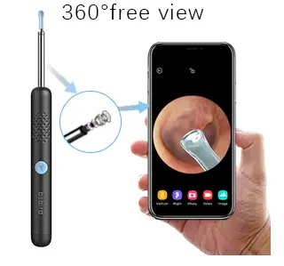 BEBIRD-R1-Ear-Wax-Removal Tool-Bebird-Ear-Wax-Removal-Ear-Camera-Fig-1