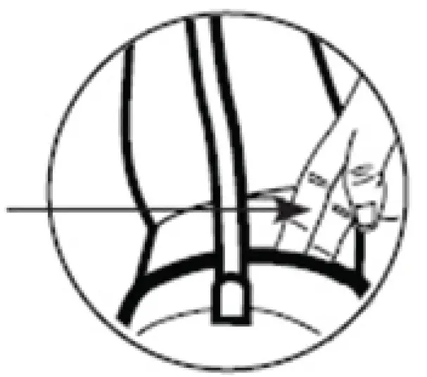 medisana-BU-582-upper-arm-Blood-pressure-monitor-17