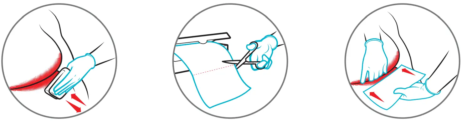 Coloplast InterDry Ag Textile with Antimicrobial Silver Complex - fig 1