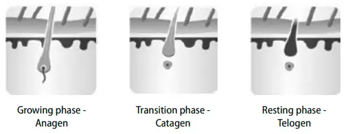 concept- IL3000 -Perfect- Skin- IPL -Epilator - fig 3