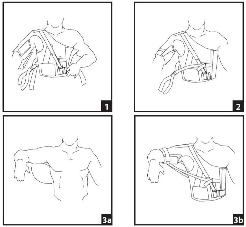 DJO DonJoy Shoulder Stabilizer - fig 1