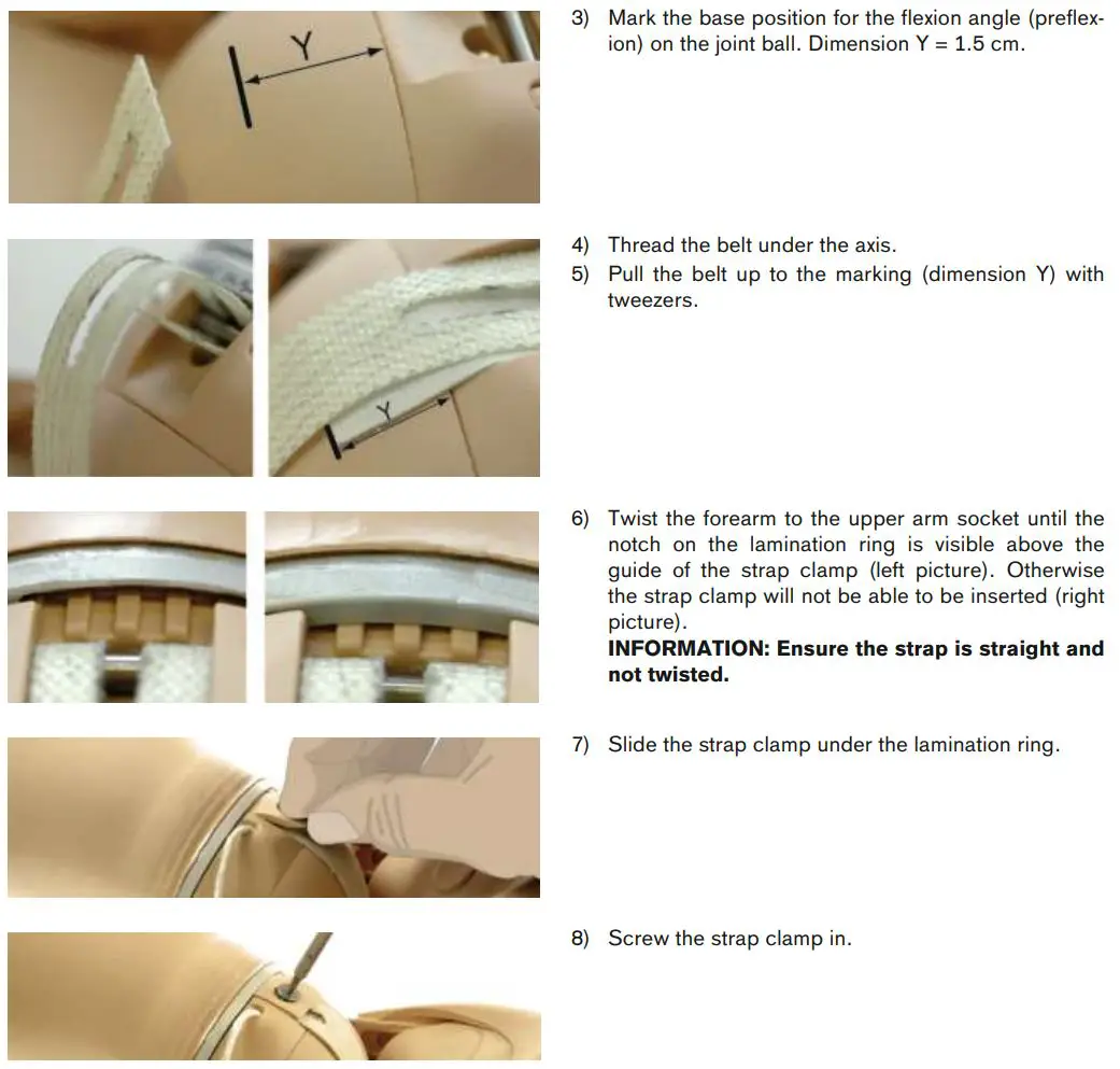 ottobock AxonArm Ergo 12K501 Instruction Manual - Connecting the Elbow Joint to the Upper Arm
