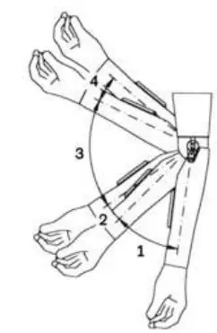 ottobock AxonArm Ergo 12K501 Instruction Manual - Setting the Preflexion