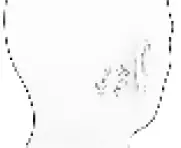 DUEARITY Tinearity G1 Treat Tinnitus Using White Noise 10