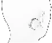 DUEARITY Tinearity G1 Treat Tinnitus Using White Noise 18