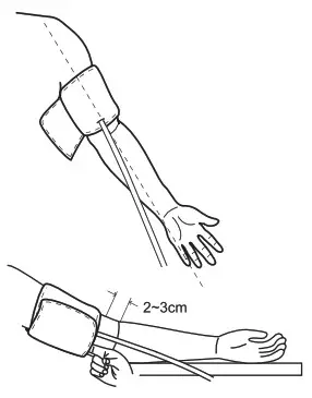 iBloodPressure SMBP802-GS-001 Cellular Blood- Tie the Cuff