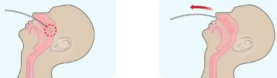 CareStart COVID 19 Antigen Test Kit - fig1