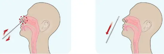 CareStart COVID 19 Antigen Test Kit - fig3