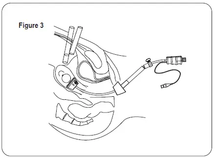 THE-O-R -COMPANY-ElevatOR-Pro-Series-FIG- (2)