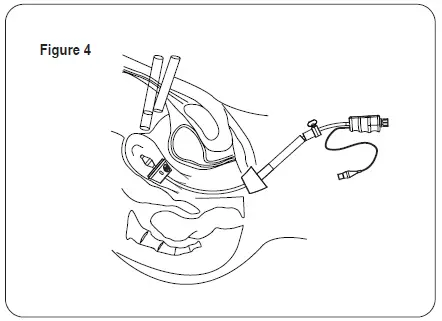 THE-O-R -COMPANY-ElevatOR-Pro-Series-FIG- (3)