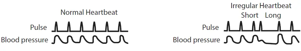 Shenzhen-Finicare-FC-BP100-Upper-Arm-Electronic-Blood-Pressure-Monitor-FIG-28