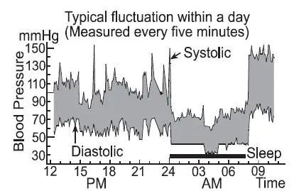 AND UA-789AC Extra Large Blood Pressure Monitor Upper Arm-fig17