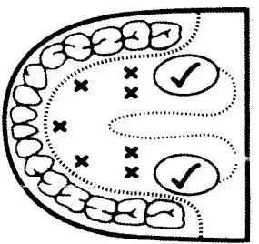 Carent DMT 101 Digital Thermometer - fig