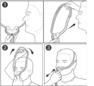 ResMed AirFit N30 Mask Headgear - mask