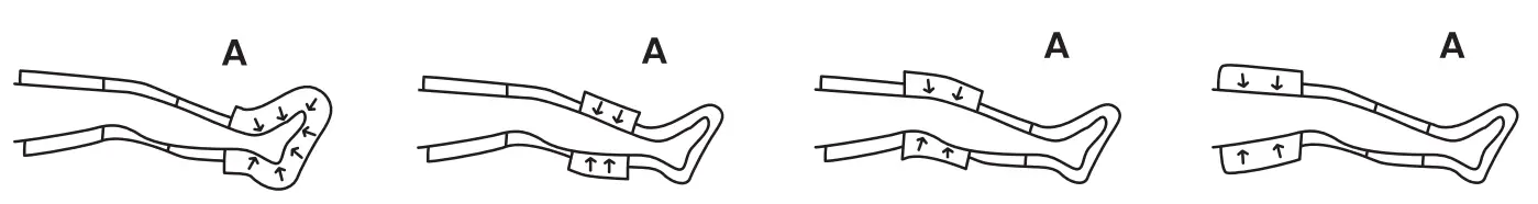 VIVE LEG Compression System RHB1019 -A