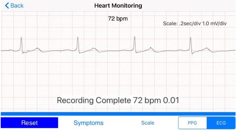 Recording your ECG