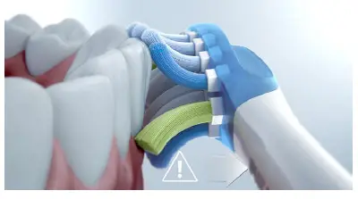 PHILIPS 9000 DiamondClean Sonic Electric Toothbrush with App- (6)