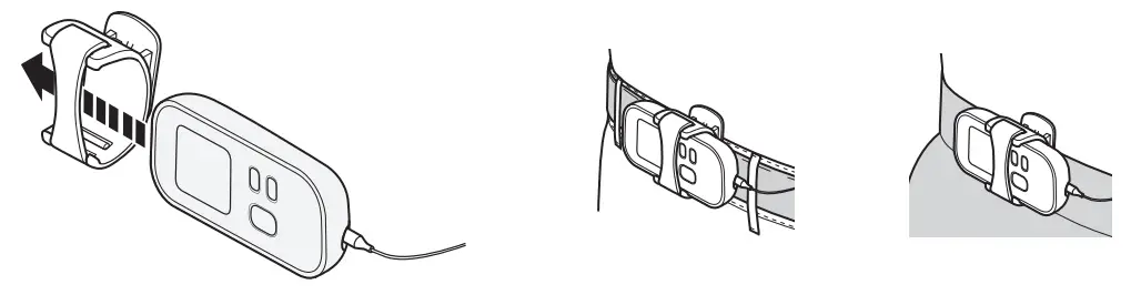 OMRON HV-F02 Electronic Nerve Stimulator - Fig 10