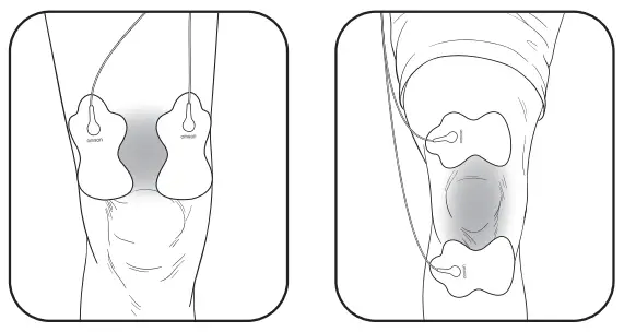 OMRON HV-F02 Electronic Nerve Stimulator - Fig 15