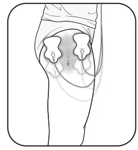 OMRON HV-F02 Electronic Nerve Stimulator - Fig 16