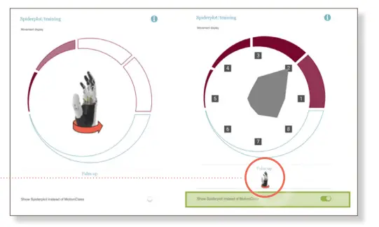 Apps-Ottobock-Myo-Plus-Pattern-Recognition-App-FIG11