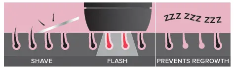 SMOOTHSKIN-Bare-Fit-IPL-Permanent-Hair-Removal-FIG-2