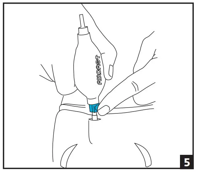 DJO L4360 L4361 Aircast XP Walker Extra Pneumatic - using instruction 5