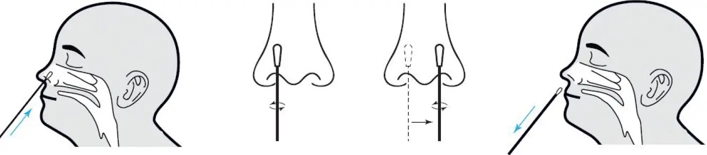 Specimen Collection and Handling 01