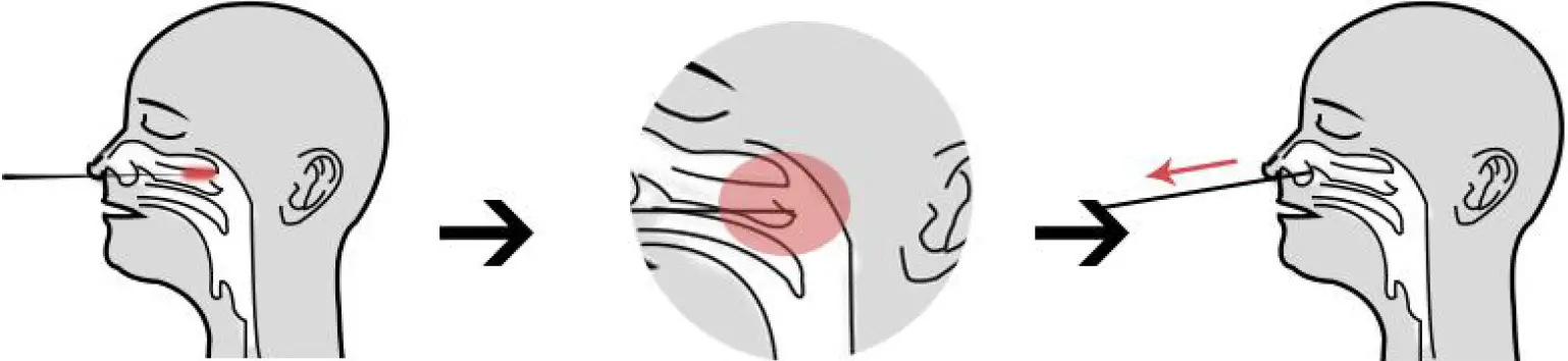 Specimen Collection and Handling 02