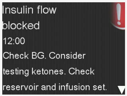 Medtronic MiniMed 780G System Insulin Pump - Alarm