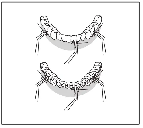 teesa TSA8001 Wireless Irrigator Easy Care Oral Irrigator - fig 5