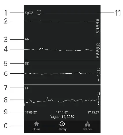 DongGuan XO201 Pulse Oximeter fig 13