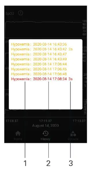 DongGuan XO201 Pulse Oximeter fig 15