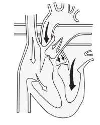 zewa-UAM-830-Automatic-Blood-Pressure-Monitor-fig-2