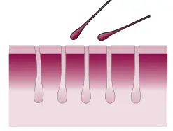 PHILIPS Hair Remover - IPL works 2