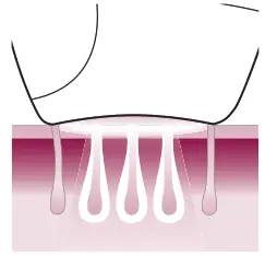 PHILIPS Hair Remover - IPL works 3