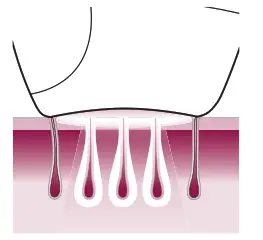 PHILIPS Hair Remover - IPL works