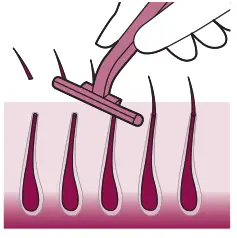 PHILIPS Hair Remover - Pretreating