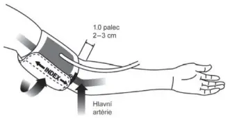 HYUNDAI BPM 700 Blood Pressure Monitor-fg11
