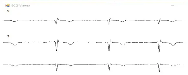 NorthEast Monitoring DR400 Patch Style Holter Recorder with Event Capabilities - Fig 12