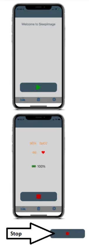 VIRTUOX SleepImage Patient - fig 5
