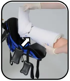 Hillrom-A-93005-Allen-Traction-Boot-Fig-47