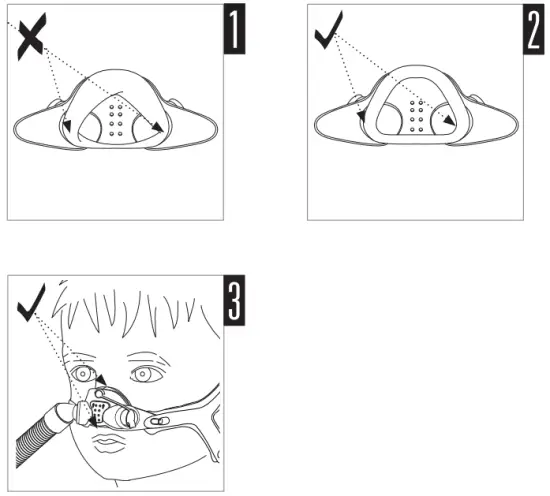 RESMED 61032 Pediatric 9