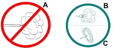 Hillrom NP100 Bidensity High Resilience Foam Mattress - Dry Steam Cleaning the Mattress