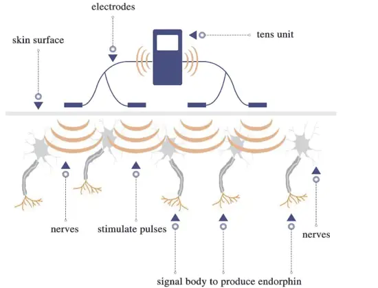 ANLAN=TENS-Unit-Muscle-Stimulator-for-Pain-Dual-Channel-Electric-Pulse-Muscle-Massager-Fig-2