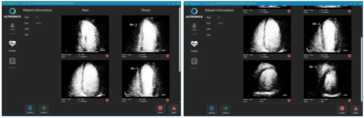 ULTROMICS EchoGo Pro v1.0.5 Clinician fig 1