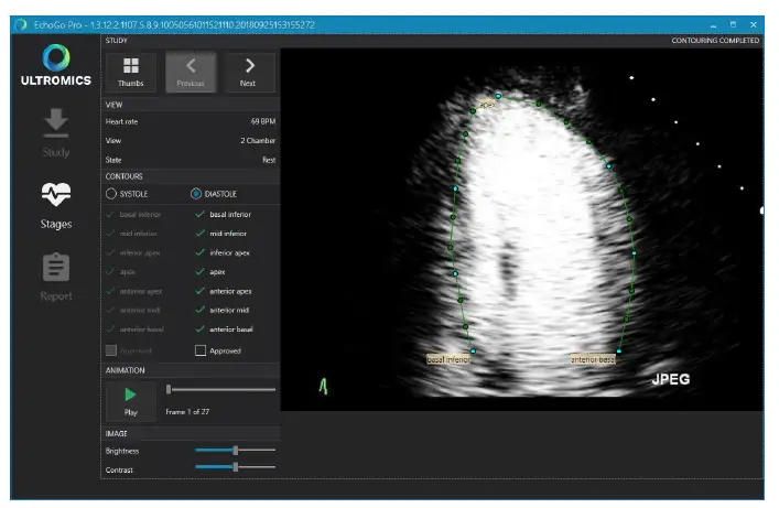ULTROMICS EchoGo Pro v1.0.5 Clinician fig 2