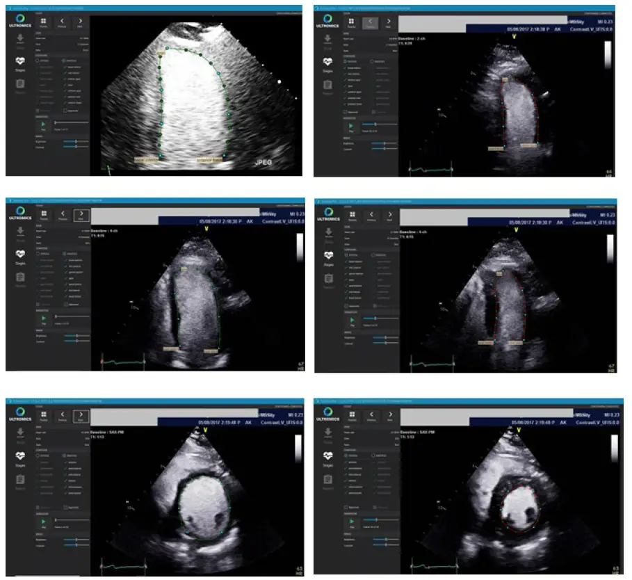 ULTROMICS EchoGo Pro v1.0.5 Clinician fig 5