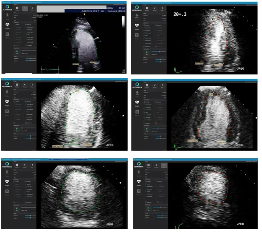 ULTROMICS EchoGo Pro v1.0.5 Clinician fig 6