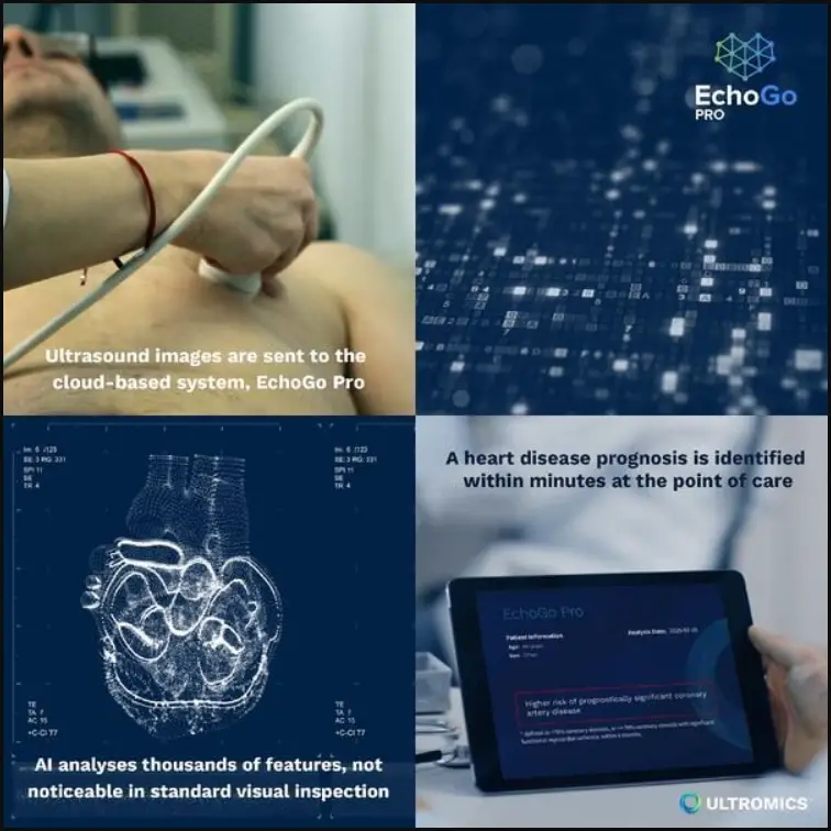 ULTROMICS EchoGo Pro v1.0.5 Clinician product